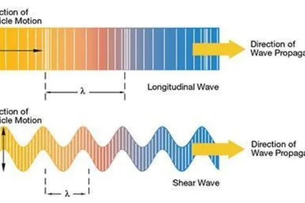 What is Ultrasound?